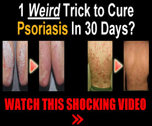 Fight Psoriasis